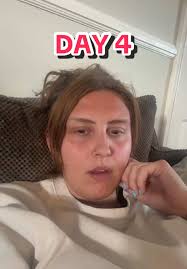 Supportive Housing for Recovery: Day 4 Insights