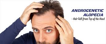 Best hair loss treatment for thicker hair: Healing Hair Loss With Homeopathy