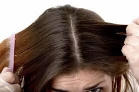 You can use homemade remedies or otc medicated shampoos to treat an itchy scalp. What Is Best Remedy For Dandruff And Hairfall Quora