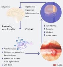 Herpes kann auch an anderen stellen des körpers auftreten, vor Stress Und Lippenherpes Ein Psycho Viraler Teufelskreis Pz Pharmazeutische Zeitung