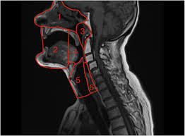 Check spelling or type a new query. Imaging In Head And Neck Cancers Bja Education