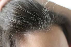 Just like premature graying can occur in young adults, it is also possible for children across all ages to grow some strands of white or gray hair. Premature White Hair Is A Common Hair Problem Nowadays That People Are Faced With This Blog Has Grey Hair Remedies Grey Hair Home Remedies Natural Hair Styles