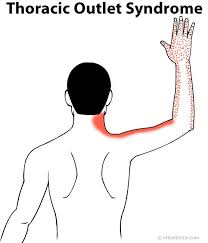 Pin On Symptoms