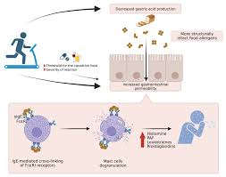 Image result for Exercise-Induced Anaphylaxis