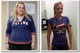 Account Suspended Sleeve Gastrectomy Sleeves Sleeve Surgery