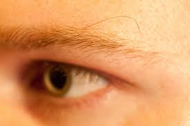 Chemotherapy can cause hair loss, including the eyebrows.; Why Does Just One Hair Grow Thicker Darker And Longer Than Others In My Eyebrow Quora