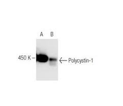 Polycystin-1 (7E12) Antibody sc-130554 from Santa Cruz Biotechnology, Inc. 