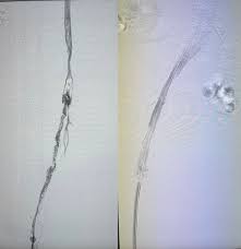 Jack Cheadle (@GAC_MDVasc)