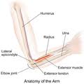 The anatomy of the elbow the elbow is a hinged joint made up of three bones, the humerus, ulna, and radius. Arm Wikipedia