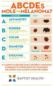 Atypical mole is another term for an irregular mole. Mole Or Melanoma 5 Tips For Detecting Skin Cancer Baptist Health Blog