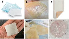 Image result for Hydrogel Dressing