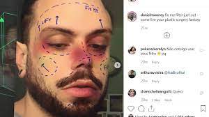 Instagram Is Banning Plastic Surgery Effect Filters Ctv News