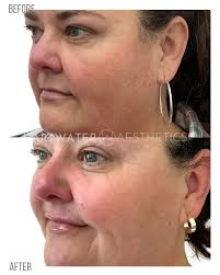 Stephanie Squires (@aesthetics_bysteph) • Instagram photos and videos