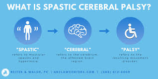 The role of the lawyer varies greatly across legal jurisdictions, and so it can be treated here in only the most general terms. Cerebral Palsy Lawyers Legal Help For Cp Cases