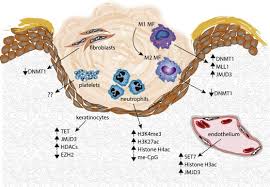 Strauss, william tettelbach, eugene r. Targeting Epigenetic Mechanisms In Diabetic Wound Healing Translational Research