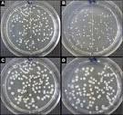 General appearance of the bacterial colonies grown on agar plates ...