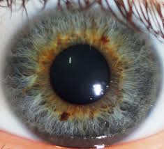 Black And Blue Eyes After Head Injury Pin By Marina On Iridologia Eye Color People With Blue Eyes Iridology