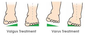 Its lateral border does not extend past the 1st interspace, and the lateral edge can. Orthotic Additions Forefoot Wedges Icb Medical