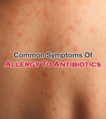 Commonly Found Symptoms Of Allergy To Antibiotics Vitamins For Skin Dry Skin Vitamins Allergies