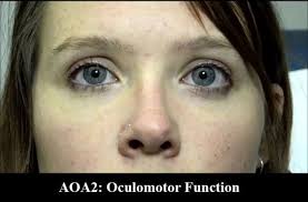 Image result for Paraknoxia