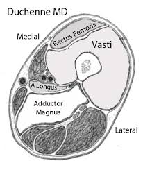 Check spelling or type a new query. Muscle Mri