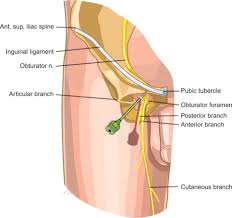 Image result for Obturator Nerve Compression