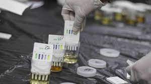Warna air kencing pengguna narkoba. Berapa Lama Narkoba Hilang Dalam Urine Dan Darah