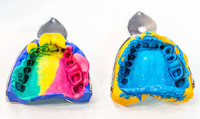 A Guide To Selecting Impression Material Dental Products Report