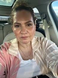 I'm 29 looking to have a mini lift to correct damage from filler dissolver  and heat devices 😞 Can someone recommend someone for me? I feel as thought  it's just the top