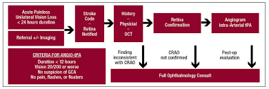 Image result for Acute Vision Loss