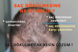 Sac Dokulmesine Ne Iyi Gelir Sac Epilasyon Sac Dokulmesi