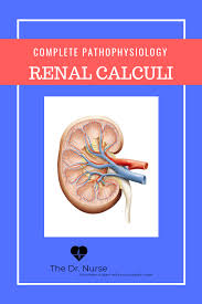 Click Through For A Complete Description Of The Pathophysiology Of Renal Calculi This Is Only A Sneak Peek Of Nurse Nursing Videos Pediatric Registered Nurse
