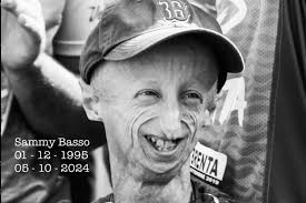 Apa Itu Progeria, Penyakit Langka Penyebab Sammy Basso Meninggal? Halaman  all