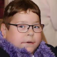 Face Aging via Diffusion-based Editing