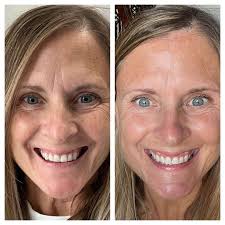 Building a skincare routine with Oliveda products for healthy and glowing  skin