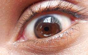 Porém, parasitas nos olhos são encontrados com pouca frequência. Em Caso Inedito Na Medicina Mulher Descobre 14 Vermes Vivos Dentro Do Olho Saude Ig