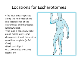 The office of the surgeon general, borden institute. Emergency Care Care At The Scene Airway Once Flames Are Extinguished Initial Attention Must Be Directed To The Airway Immediate Cpr Is Rarely Necessary Ppt Download