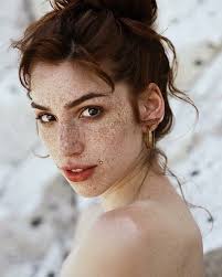 So charming freckles