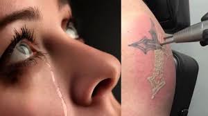Watch how laser tattoo removal is work video so, the main question would be, can you remove a tattoo with these procedures?. How Much Does Laser Tattoo Removal Hurt Tattoo Ideas Artists And Models