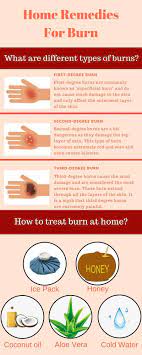 Home Remedies For Burn What You Should Do Firstdegreeburn Home Remedies For Burns Burn Remedy Home Remedies