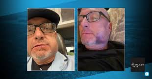 Local umpire assaulted during game; Owensboro man arrested