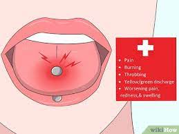 3 Ways To Reduce Tongue Swelling - Wikihow