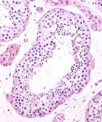 Maybe you would like to learn more about one of these? Seminiferous Tubule Wikipedia