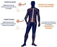 Maladie de Charcot Traitement naturel