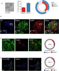 5 Oxoete Triggers Nociception In Constipation Predominant