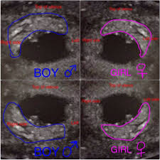 Pin On Gender Predictor Tests