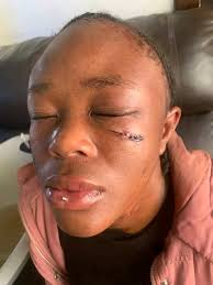 Well, she slipped while brushing her teeth. And died!! Thank you for the go  back in time button because I am not ready!