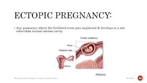 During, or after a seizure. 38 Normal Pictures Of Spotting During Pregnancy Background Wild Country Fine Arts