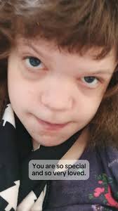 Hunter passed away from Sanfilippo Syndrome in 2017. Forever 15. This is  what his brother Mason fondly remembers.