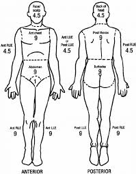 Percentage Of Burns Diagram Get Rid Of Wiring Diagram Problem